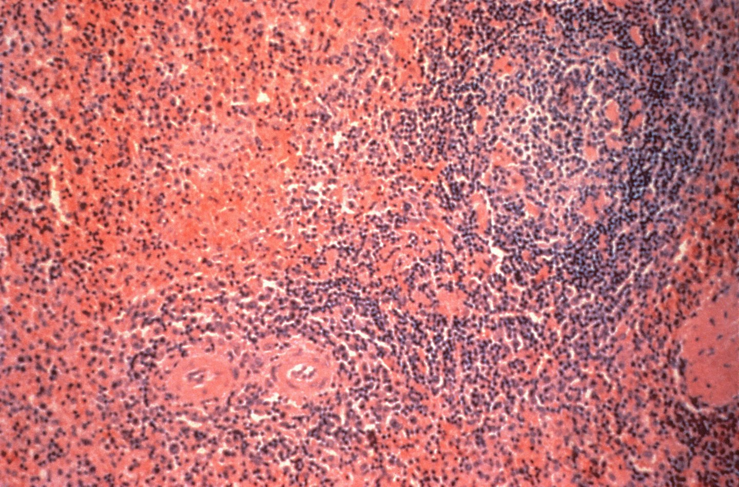Tejido biológico teñido que revela estructuras celulares intrincadas bajo un microscopio.