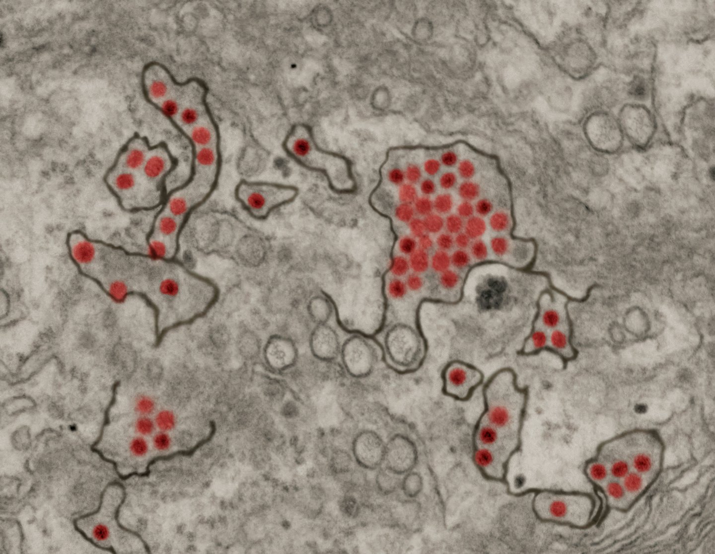 Vista microscópica de células con pequeñas estructuras esféricas rojas.