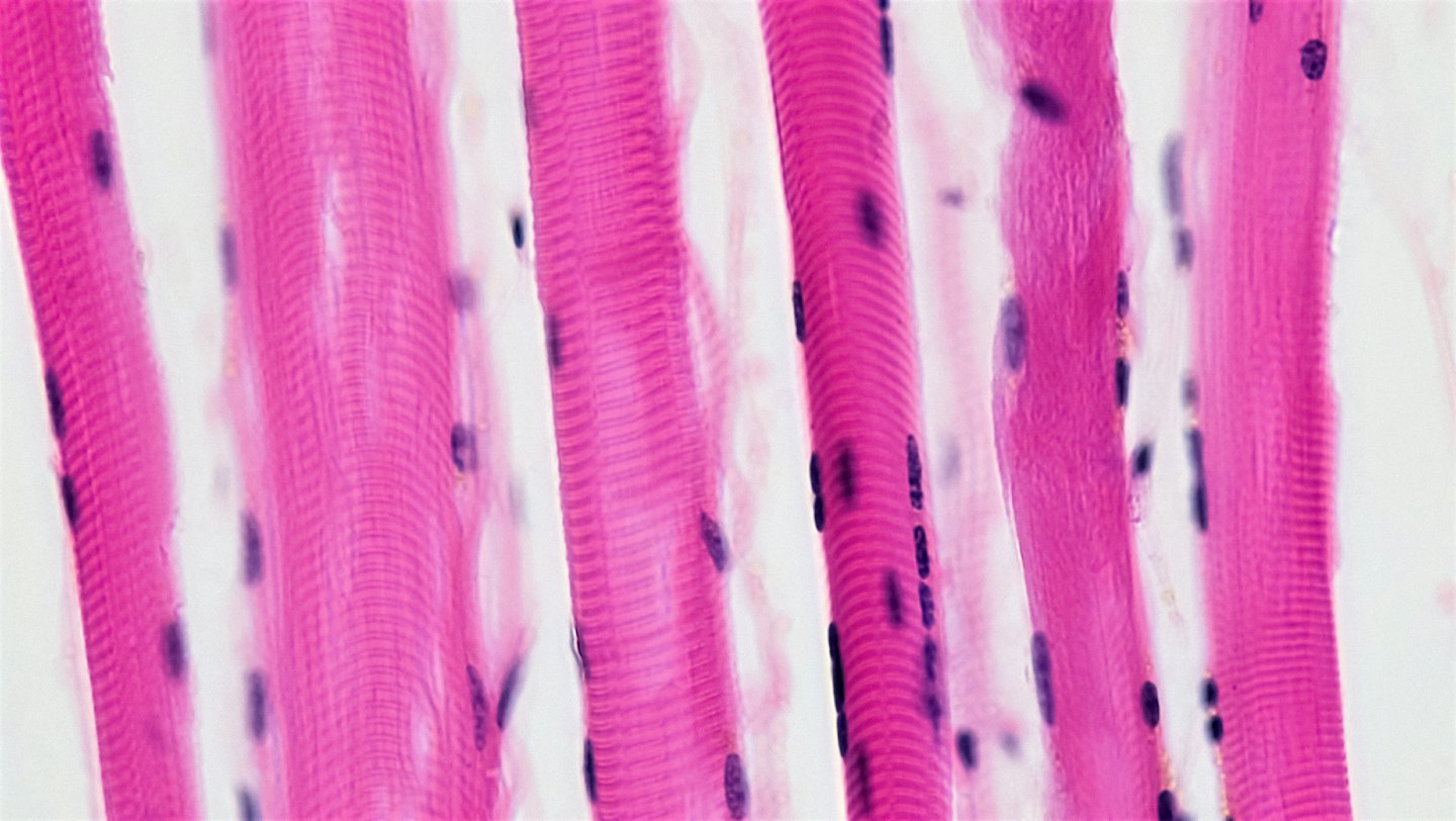 Vista microscópica de fibras musculares rosas y núcleos celulares morados.