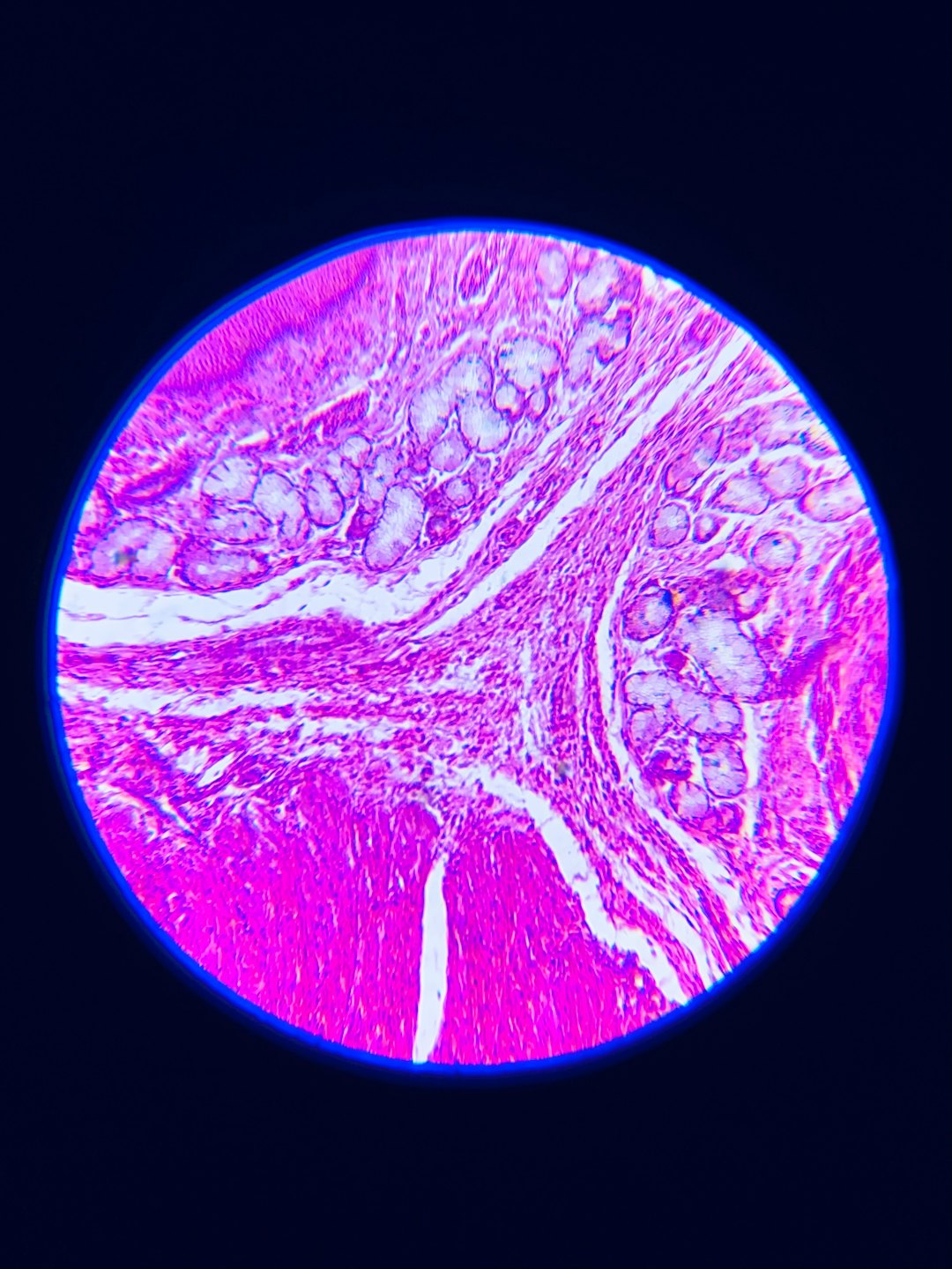 Vista microscópica de tejido biológico teñido de rosa y morado.
